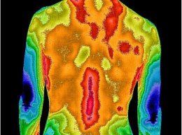 Thermal image of a back