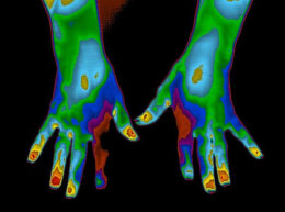 Thermal image of hands